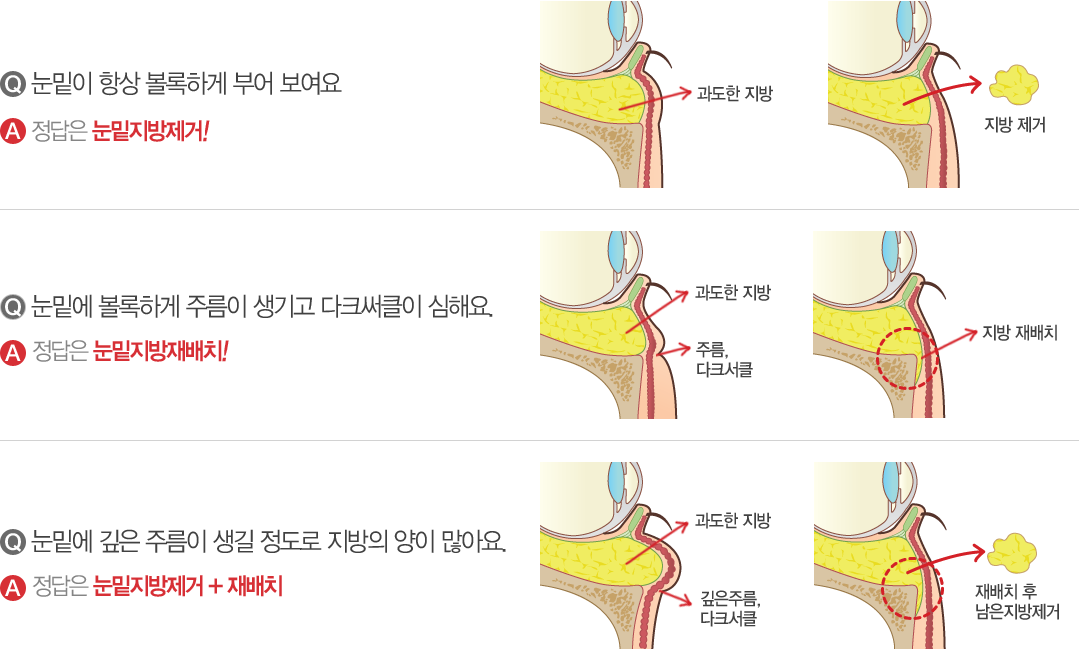 내용