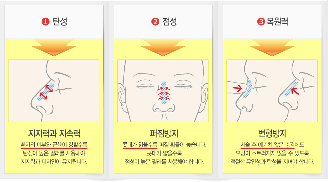 탄성/점성/복원력